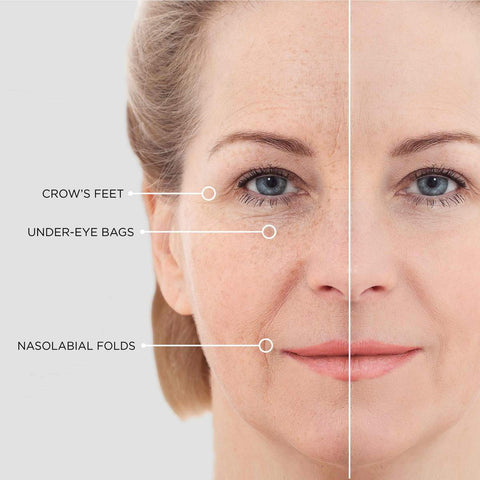 Wrinkle & Eye Bag Repair Microneedle Patch