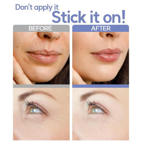 Wrinkle & Eye Bag Repair Microneedle Patch