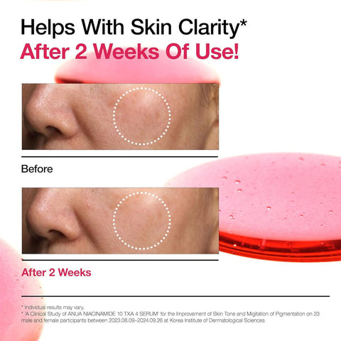 Anua Niacinamide 10% + TXA 4% Serum
